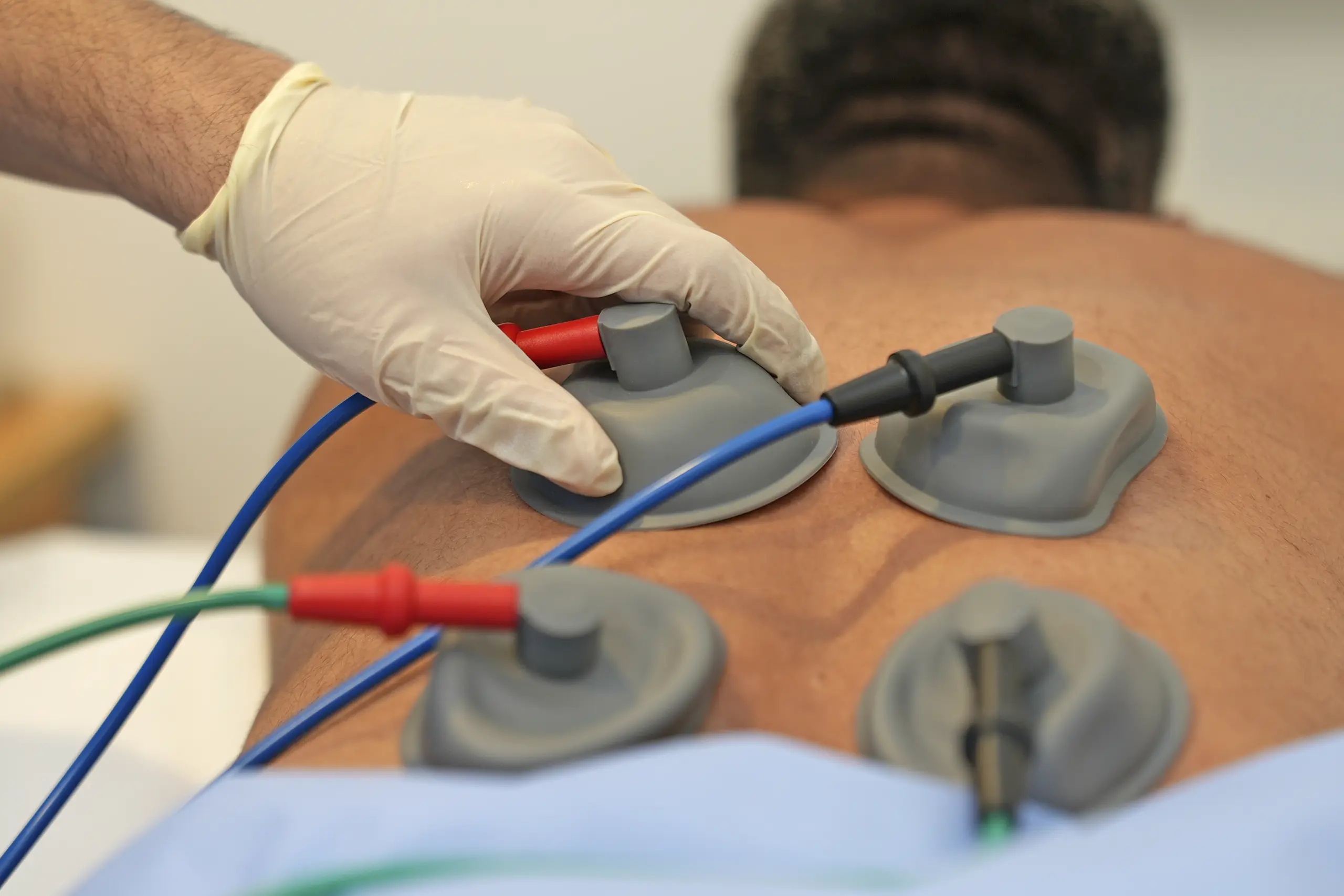 Electric Cupping